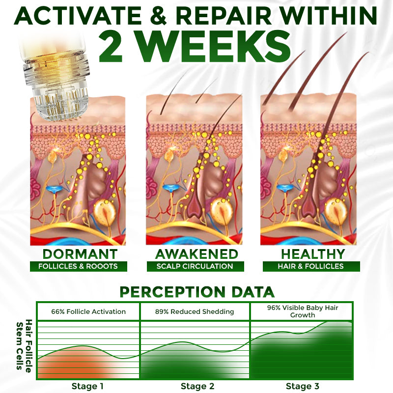 👱♂️ Medazy® Microneedle Herbal Infusion Hair Stimulation Set 🇺🇸 Recommended by