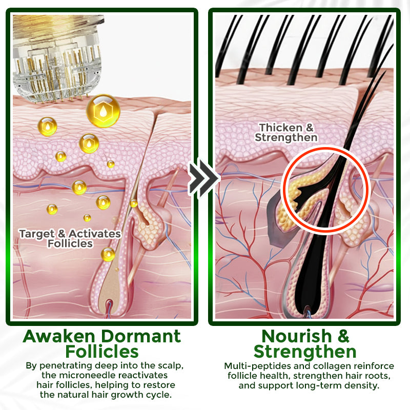 👱♂️ Medazy® Microneedle Herbal Infusion Hair Stimulation Set 🇺🇸 Recommended by