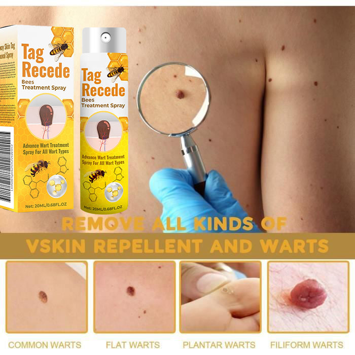 ✅ Official store: 🔥🐝Medazy™TagRecede Bee Spray ✨👨⚕️ Approved by the American Association of Dermatology (AAOS)