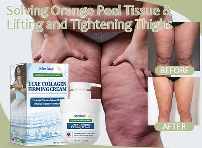 💫[👨‍⚕️Official Brand Store👨‍⚕️] Medazy™ Luxe Collagen Firming Cream