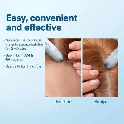 Hair Growth Roll-On Serum – See hair growth in 4 weeks