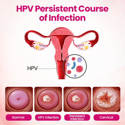 HPV negative conversion power MAX! LOVILDS™ interferon gel: Targeting high-risk viruses and repairing the cervix in one step