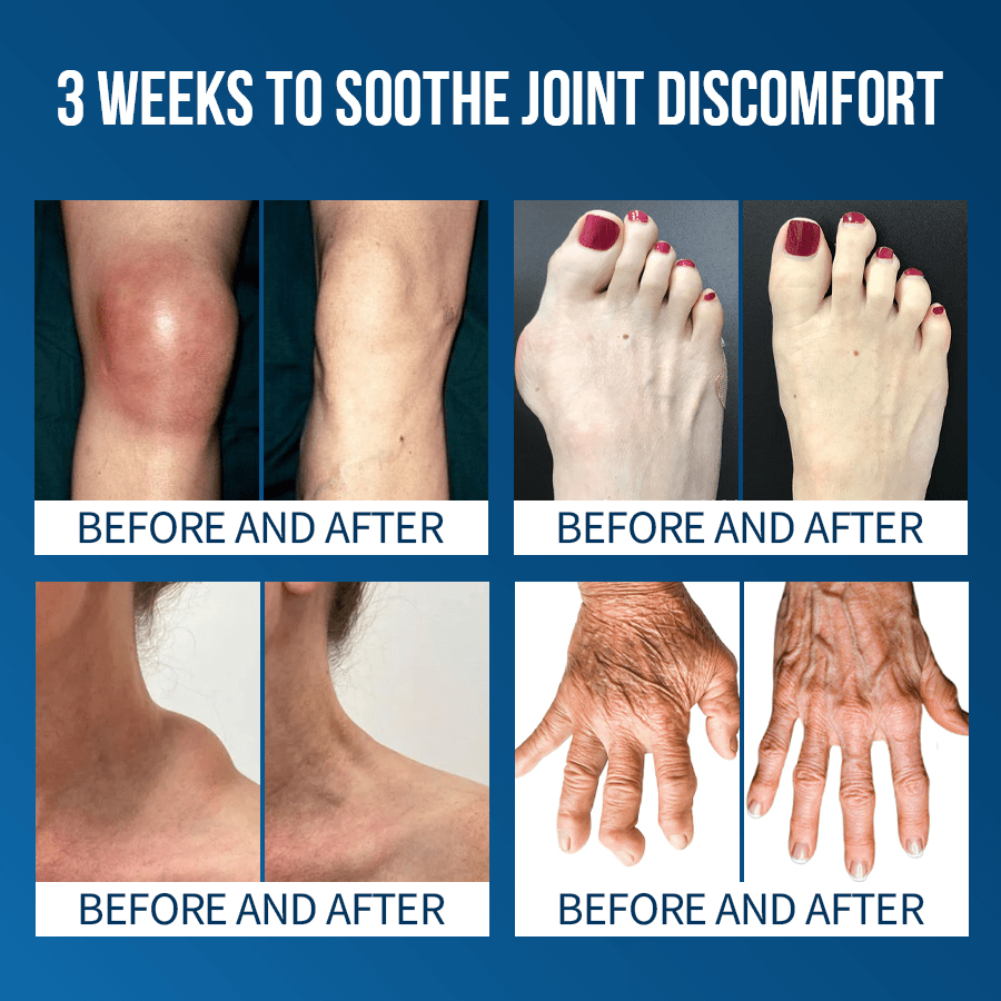 LOVILDS® Flexfixer Joint Relief Serum Ampoule 🔆