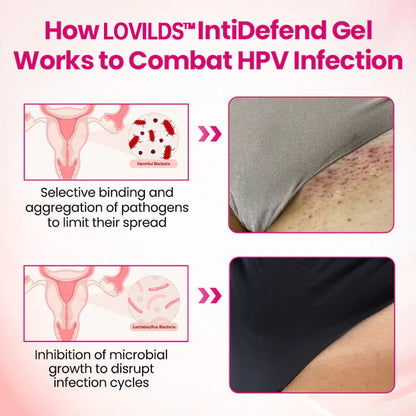 HPV negative conversion power MAX! LOVILDS™ interferon gel: Targeting high-risk viruses and repairing the cervix in one step