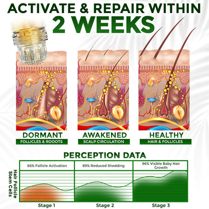 👱‍♂️ Medazy® Microneedle Herbal Infusion Hair Stimulation Set 🇺🇸 Recommended by