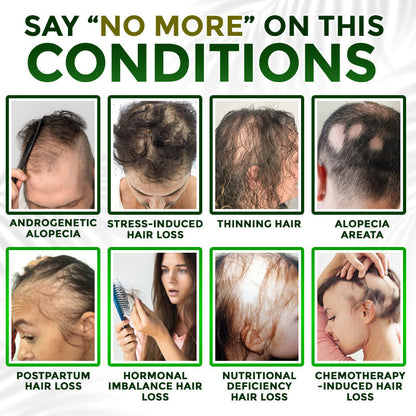 👱‍♂️ Medazy® Microneedle Herbal Infusion Hair Stimulation Set 🇺🇸 Recommended by