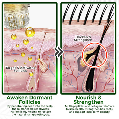 👱‍♂️ Medazy® Microneedle Herbal Infusion Hair Stimulation Set 🇺🇸 Recommended by